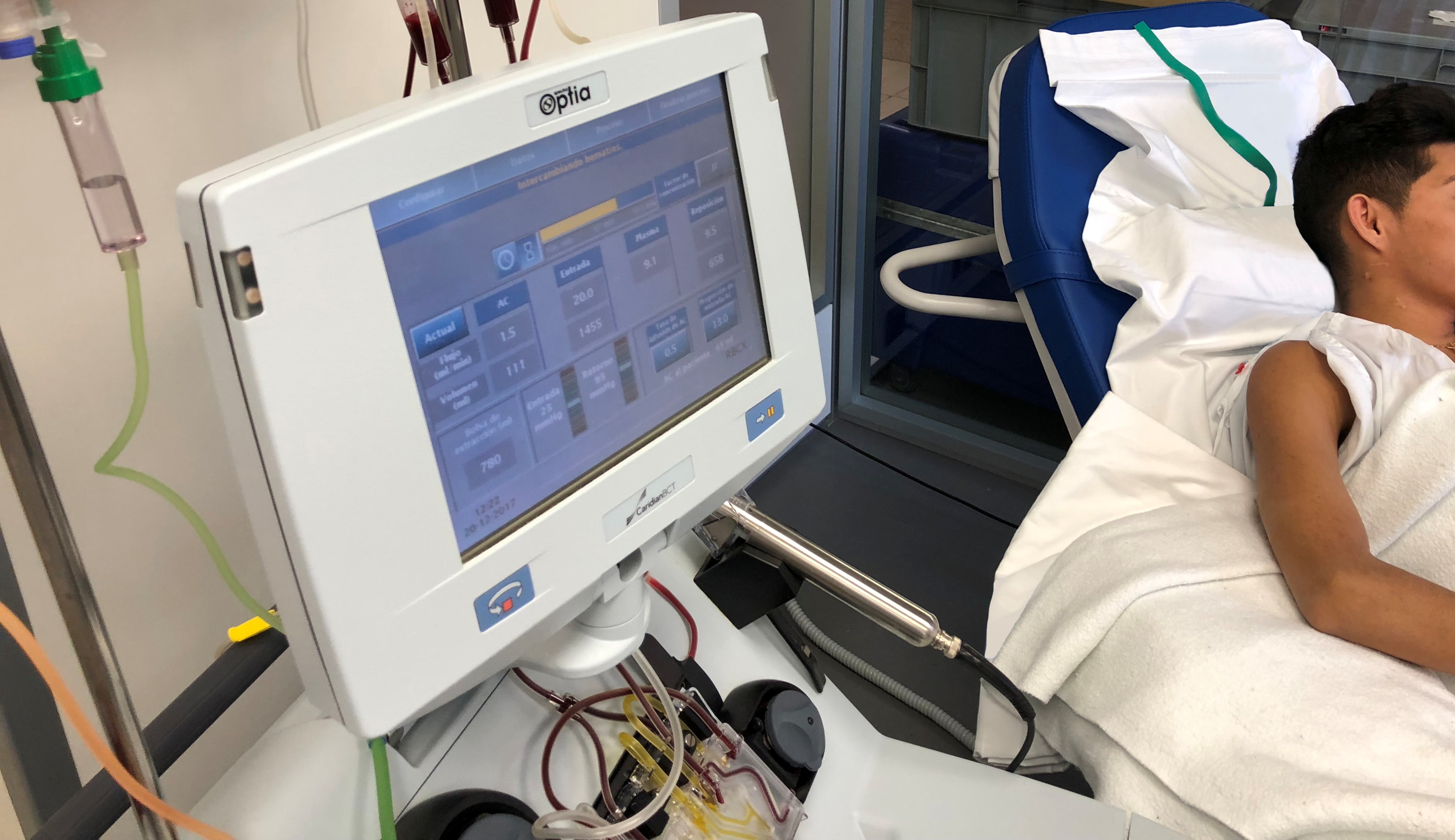 Nova unitat funcional a l’Hospital Santa Caterina per al tractament de la drepanocitosi