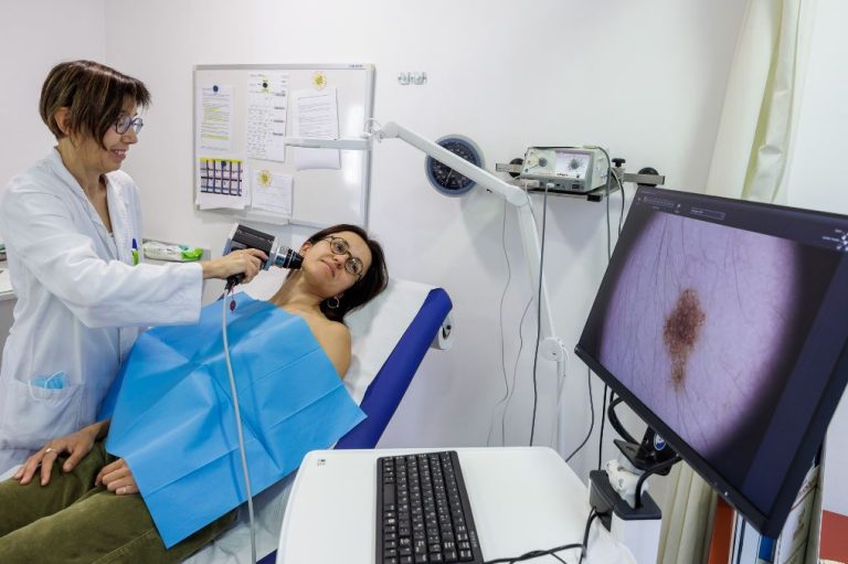 L’Hospital Santa Caterina incorpora la dermatoscòpia digital